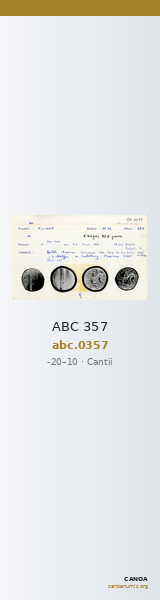ABC 357 — CANOA
