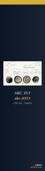 ABC 357 — CANOA