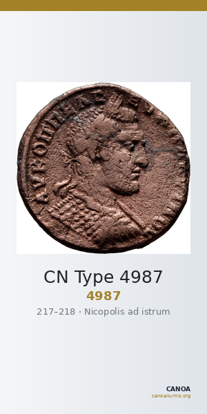 CN Type 4987 — CANOA