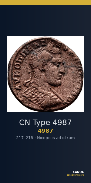 CN Type 4987 — CANOA