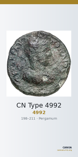 CN Type 4992 — CANOA