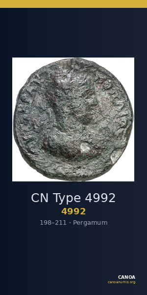 CN Type 4992 — CANOA